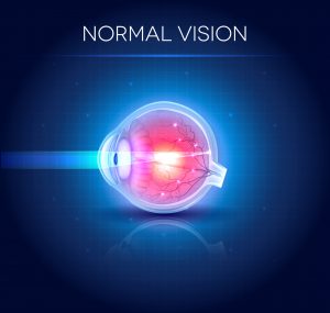 Normal Vision | Refractive Errors | Burlington County Eye Physicians