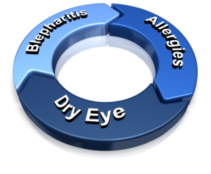 Dry eye blepharitis eye allergies