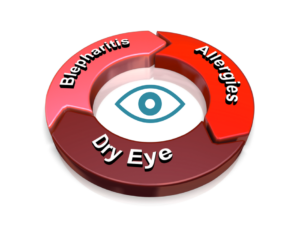 Dry Eye Blepharitis Allergies