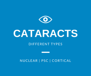 Classification of Cataracts | Burlington County Eye Physicians