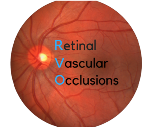 Retinal Vascular Occlusions | Diseases of the Retina
