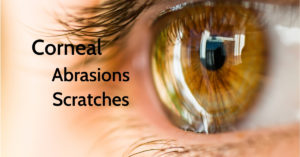 Corneal Abrasion | Sings and Symptoms | The Eye Professionals