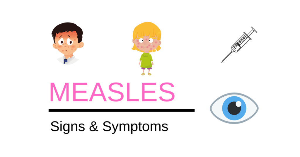Measles | Signs and Symptoms | The Eye Professionals