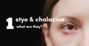 Stye Chalazion Featured Image | The Eye Professionals