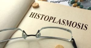 Featured Image Ocular Histoplasmosis