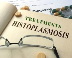 Featured Image Text Article Treatment Histoplasmosis