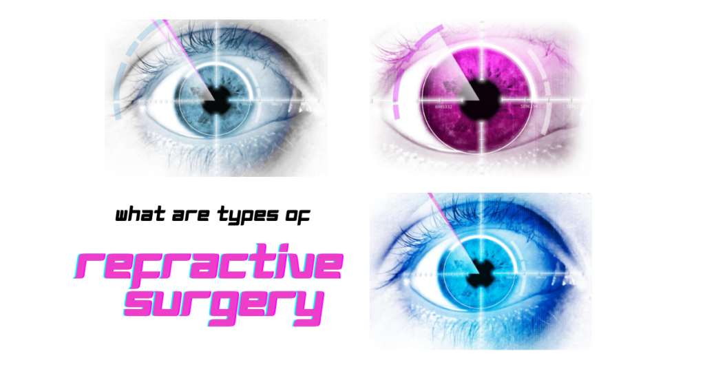 Featured Article Image | Types of Refractive Surgery