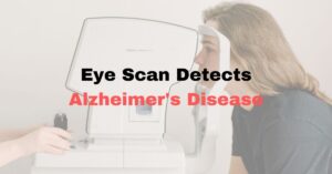 Featured Image OCT Scan and Alzheimer's disease