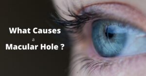 Featured Image Macular Hole
