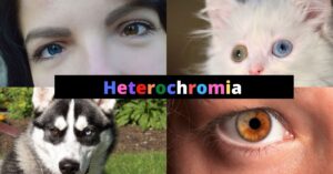 Featured Image Heterochromia