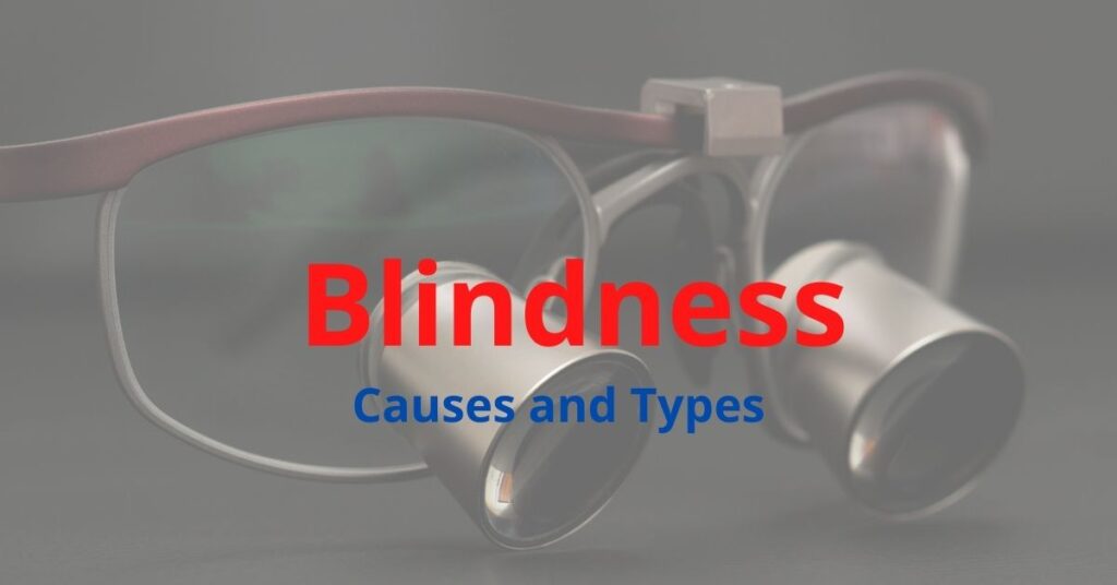 Causes and Types of Blindness Featured Image