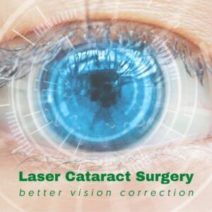 Laser Cataract Surgery Article Image