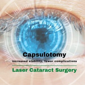 Article Featured Image Capsulotomy