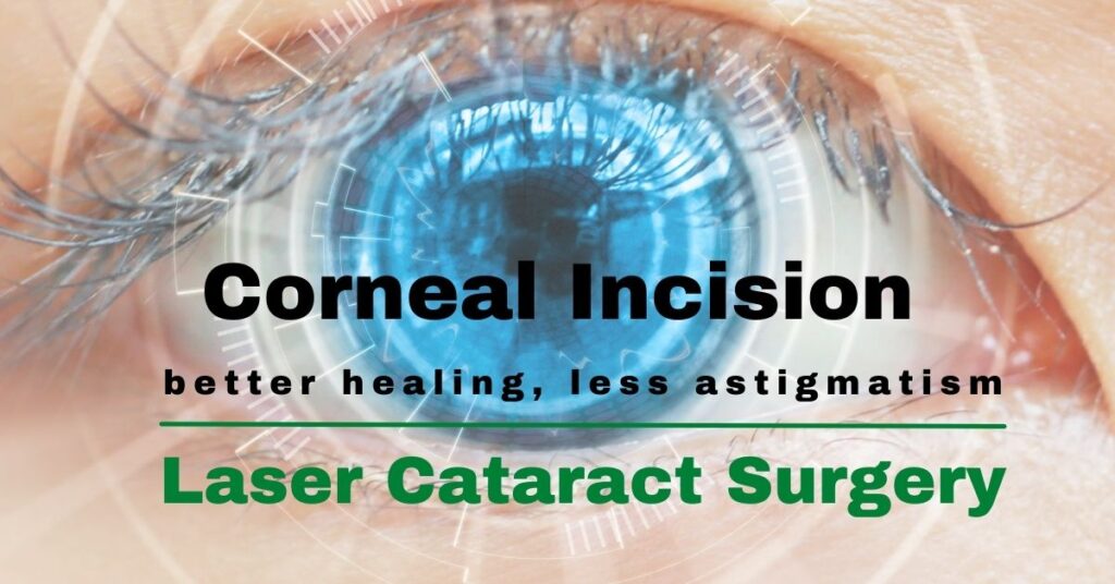 Featured Image Corneal Incision