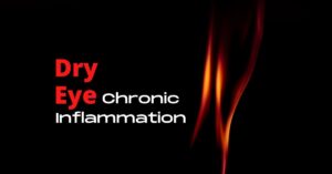 Featured Image - Dry Eye and Chronic Inflammation