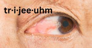 Featured image for Pterygium