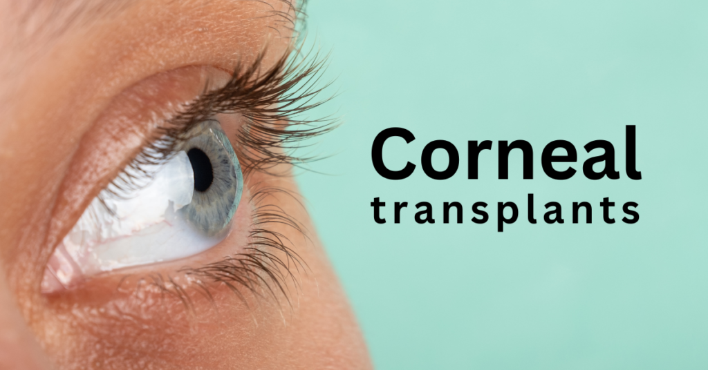 Featured Image Corneal Transplants
