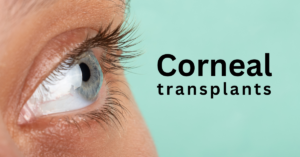 Featured Image Corneal Transplants