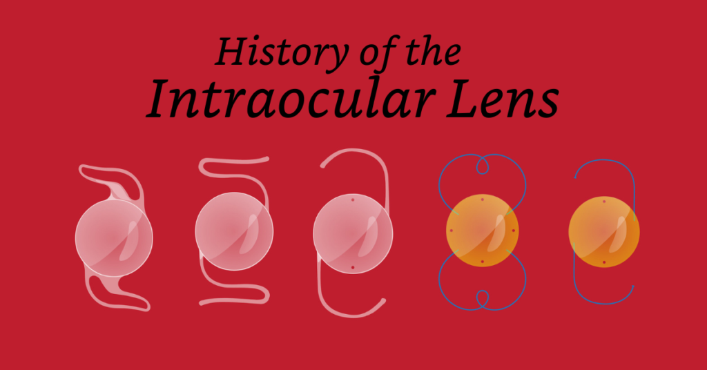 Featured Image for Intraocular Lens