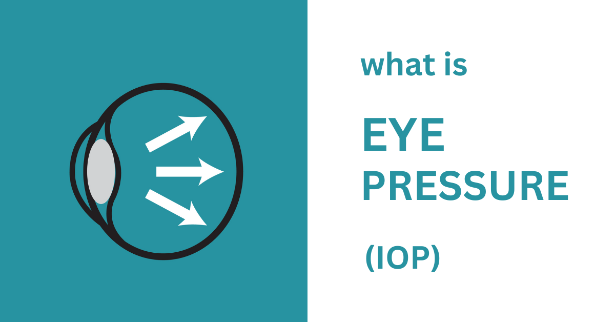 What is Intraocular Pressure (IOP) - Board Certified Eye Doctors