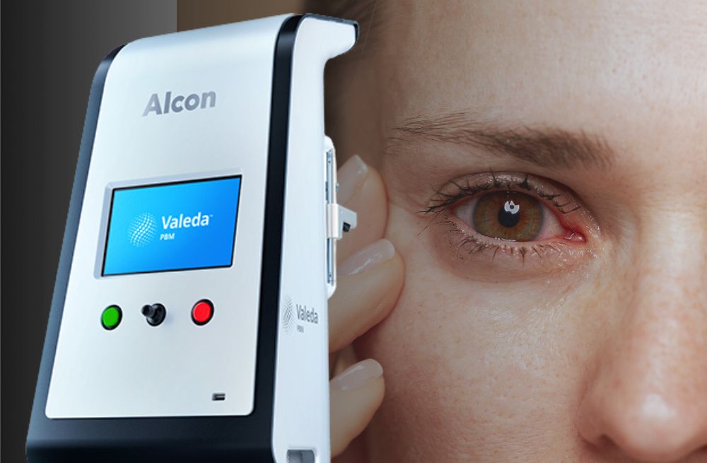 Red Light Therapy for Dry Eye Relief